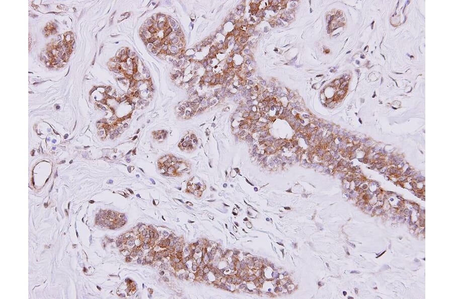 Immunohistochemistry - FSD2 antibody from Signalway Antibody (23167) - Antibodies.com