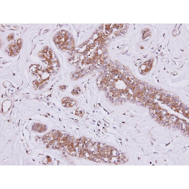 Immunohistochemistry - FSD2 antibody from Signalway Antibody (23167) - Antibodies.com