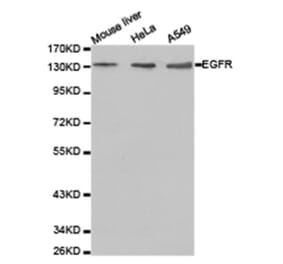Western blot - EGFR Antibody from Signalway Antibody (23630) - Antibodies.com