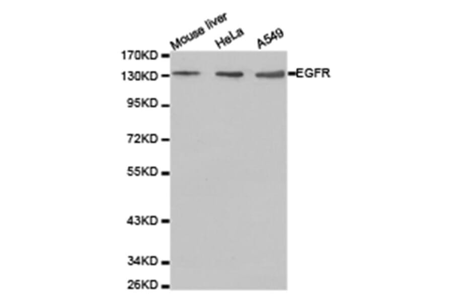 Western blot - EGFR Antibody from Signalway Antibody (23630) - Antibodies.com