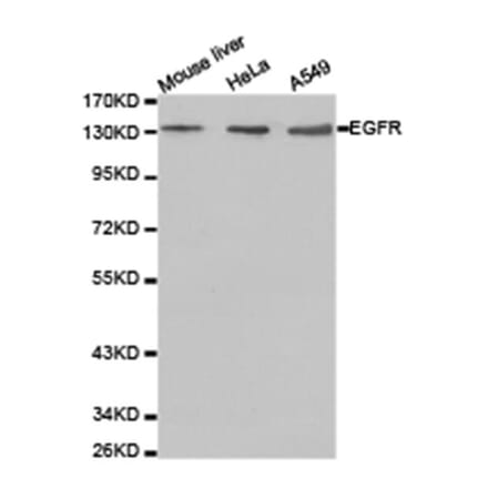 Western blot - EGFR Antibody from Signalway Antibody (23630) - Antibodies.com