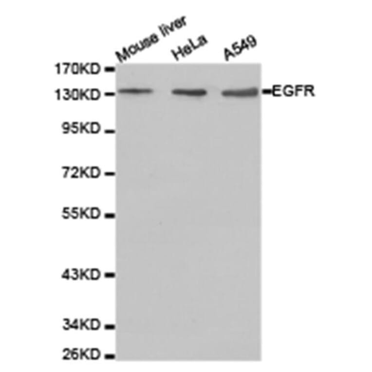 Western blot - EGFR Antibody from Signalway Antibody (23630) - Antibodies.com