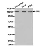 Western blot - EGFR Antibody from Signalway Antibody (23630) - Antibodies.com