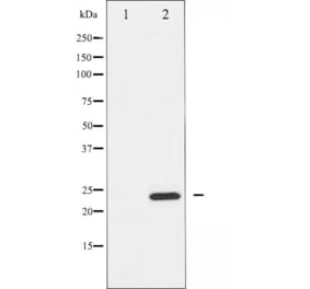 Western blot - RhoA antibody from Signalway Antibody (25545) - Antibodies.com