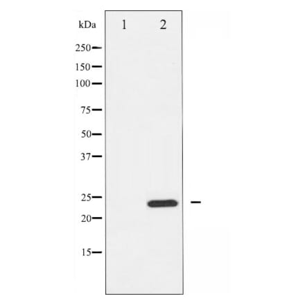 Western blot - RhoA antibody from Signalway Antibody (25545) - Antibodies.com