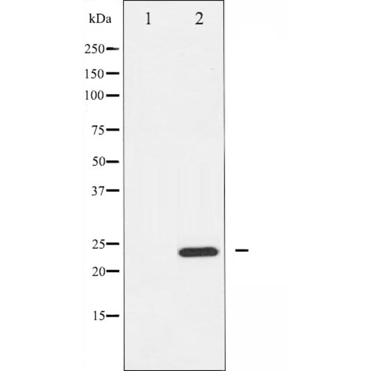 Western blot - RhoA antibody from Signalway Antibody (25545) - Antibodies.com