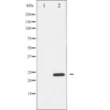 Western blot - RhoA antibody from Signalway Antibody (25545) - Antibodies.com