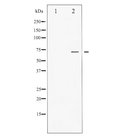 Western blot - FKHR Antibody from Signalway Antibody (29035) - Antibodies.com