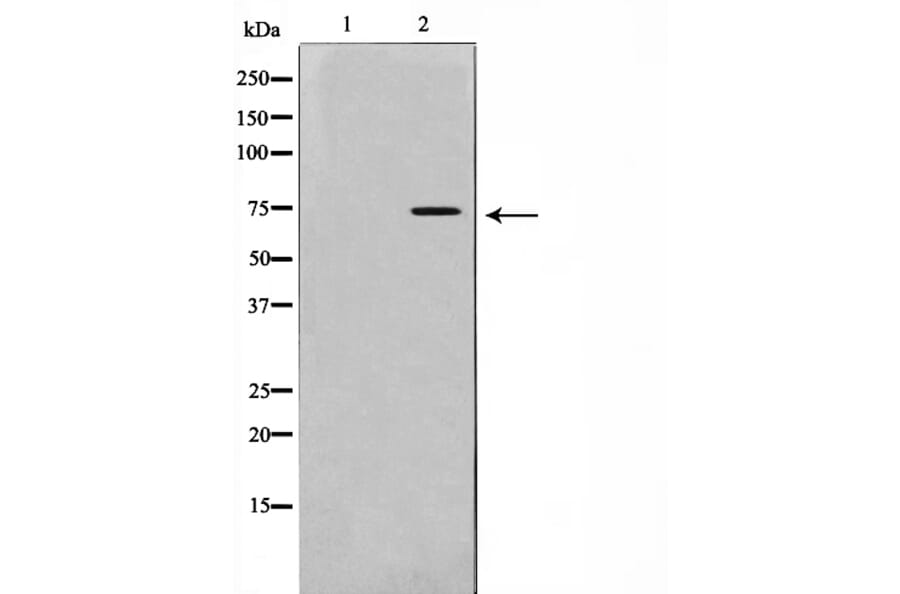 Western blot - IL2R Antibody from Signalway Antibody (29047) - Antibodies.com