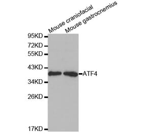 Western blot - ATF4 Antibody from Signalway Antibody (32007) - Antibodies.com