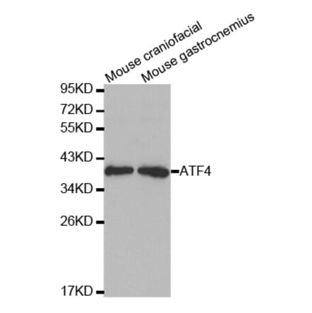 Western blot - ATF4 Antibody from Signalway Antibody (32007) - Antibodies.com