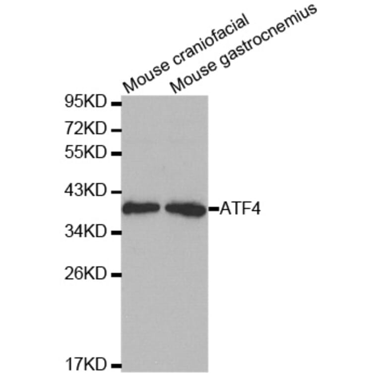 Western blot - ATF4 Antibody from Signalway Antibody (32007) - Antibodies.com