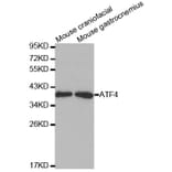 Western blot - ATF4 Antibody from Signalway Antibody (32007) - Antibodies.com