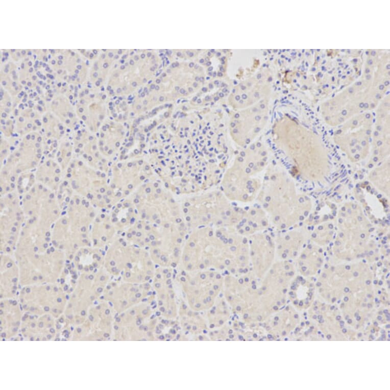 Immunohistochemistry - ATF4 Antibody from Signalway Antibody (32007) - Antibodies.com