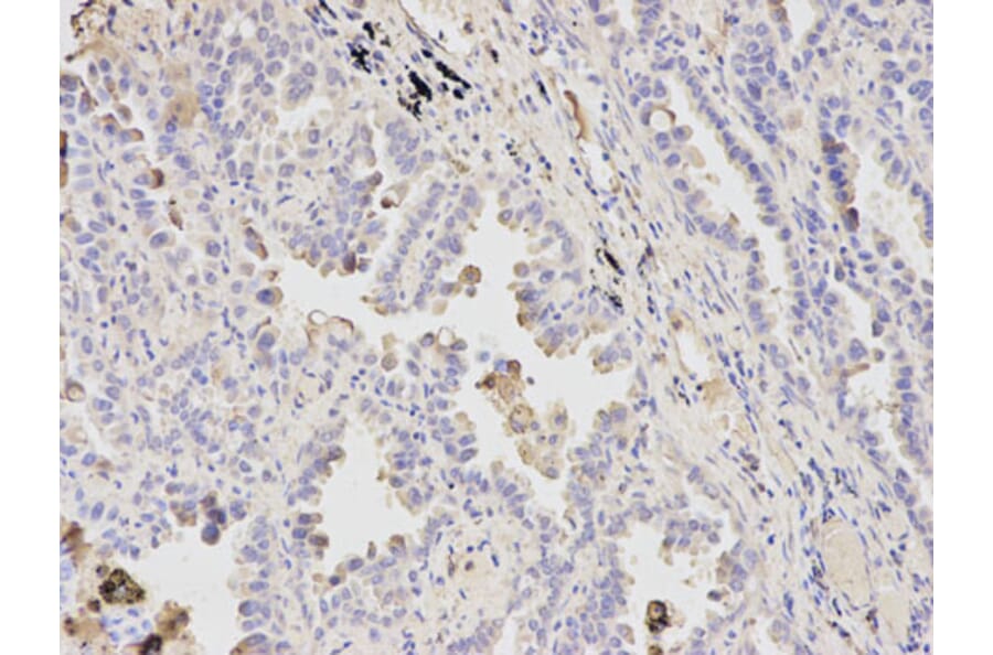 Immunohistochemistry - ATF4 Antibody from Signalway Antibody (32007) - Antibodies.com