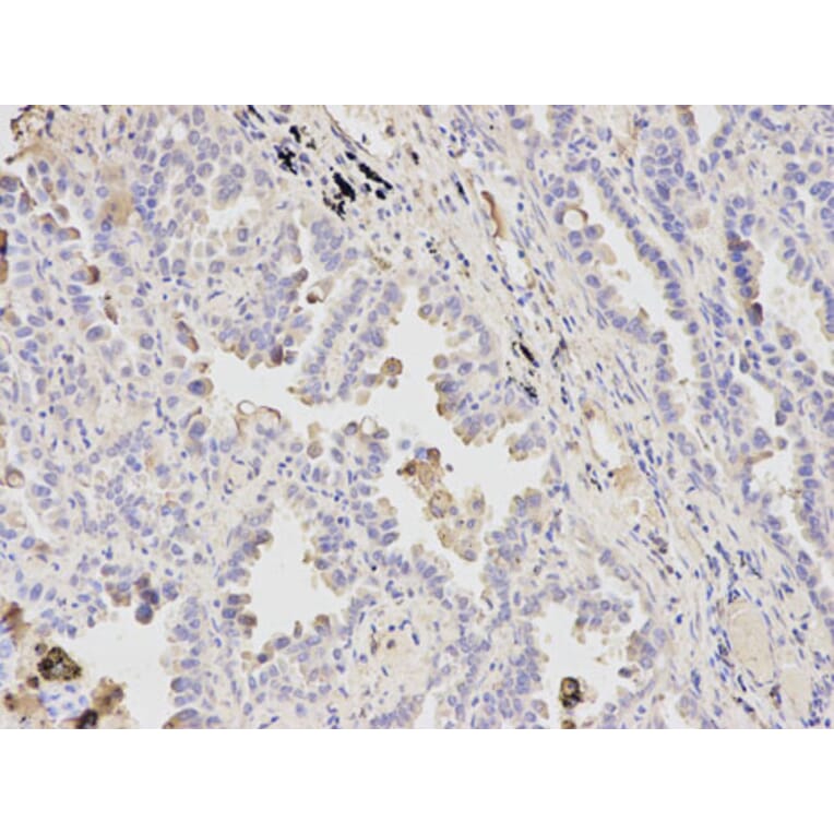 Immunohistochemistry - ATF4 Antibody from Signalway Antibody (32007) - Antibodies.com