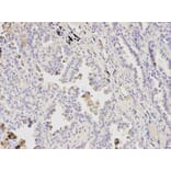 Immunohistochemistry - ATF4 Antibody from Signalway Antibody (32007) - Antibodies.com