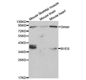 Western blot - BVES Antibody from Signalway Antibody (32017) - Antibodies.com