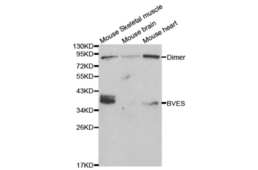 Western blot - BVES Antibody from Signalway Antibody (32017) - Antibodies.com