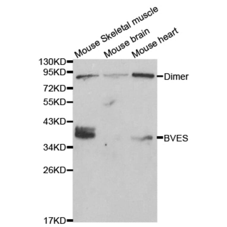 Western blot - BVES Antibody from Signalway Antibody (32017) - Antibodies.com