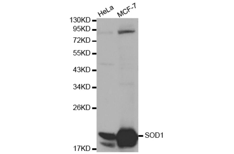 Western blot - SOD1 Antibody from Signalway Antibody (32058) - Antibodies.com