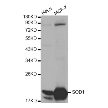 Western blot - SOD1 Antibody from Signalway Antibody (32058) - Antibodies.com