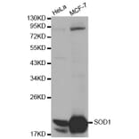 Western blot - SOD1 Antibody from Signalway Antibody (32058) - Antibodies.com