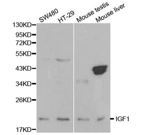 Western blot - IGF1 Antibody from Signalway Antibody (32070) - Antibodies.com