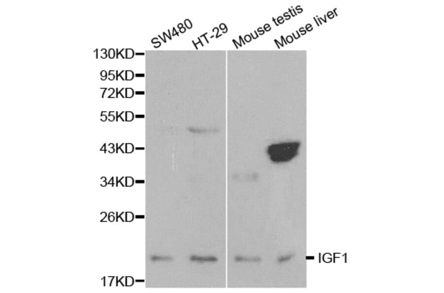 Western blot - IGF1 Antibody from Signalway Antibody (32070) - Antibodies.com