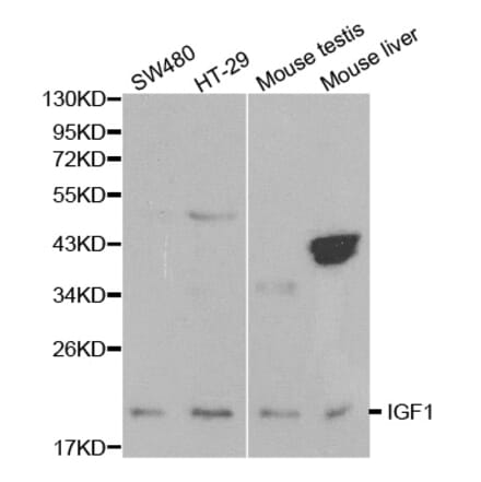 Western blot - IGF1 Antibody from Signalway Antibody (32070) - Antibodies.com