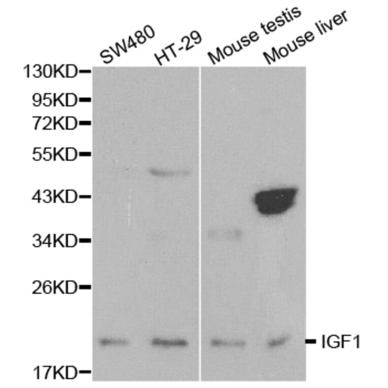 Western blot - IGF1 Antibody from Signalway Antibody (32070) - Antibodies.com