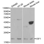 Western blot - IGF1 Antibody from Signalway Antibody (32070) - Antibodies.com