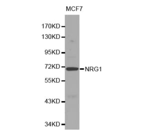 Western blot - NRG1 Antibody from Signalway Antibody (32082) - Antibodies.com