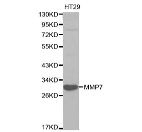 Western blot - MMP7 Antibody from Signalway Antibody (32086) - Antibodies.com
