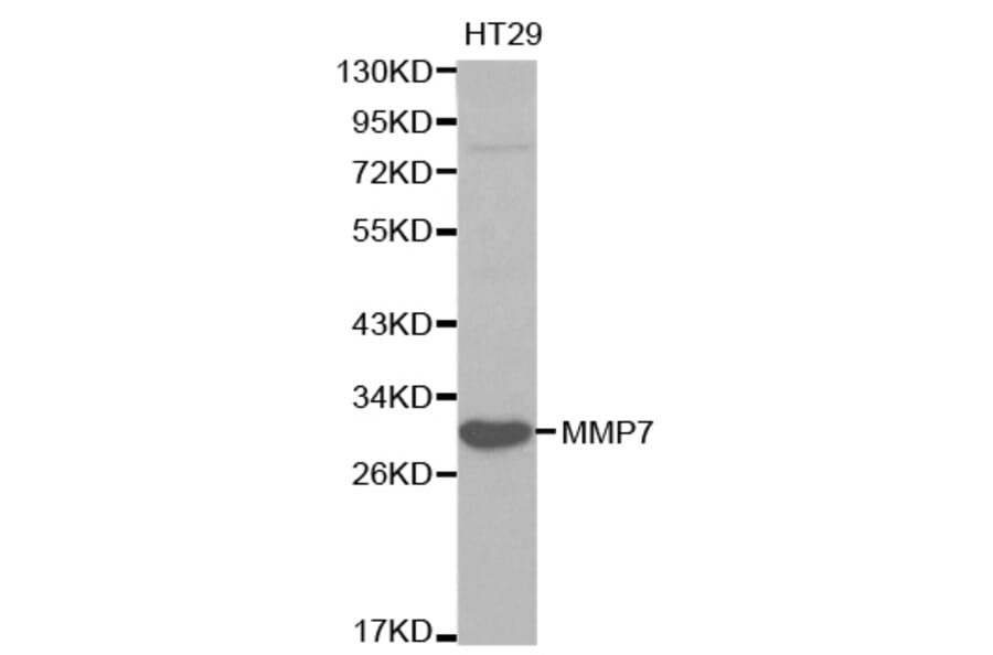 Western blot - MMP7 Antibody from Signalway Antibody (32086) - Antibodies.com