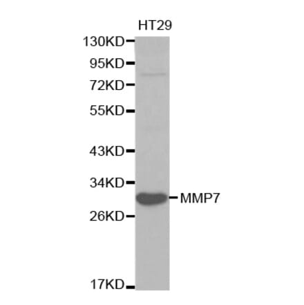 Western blot - MMP7 Antibody from Signalway Antibody (32086) - Antibodies.com