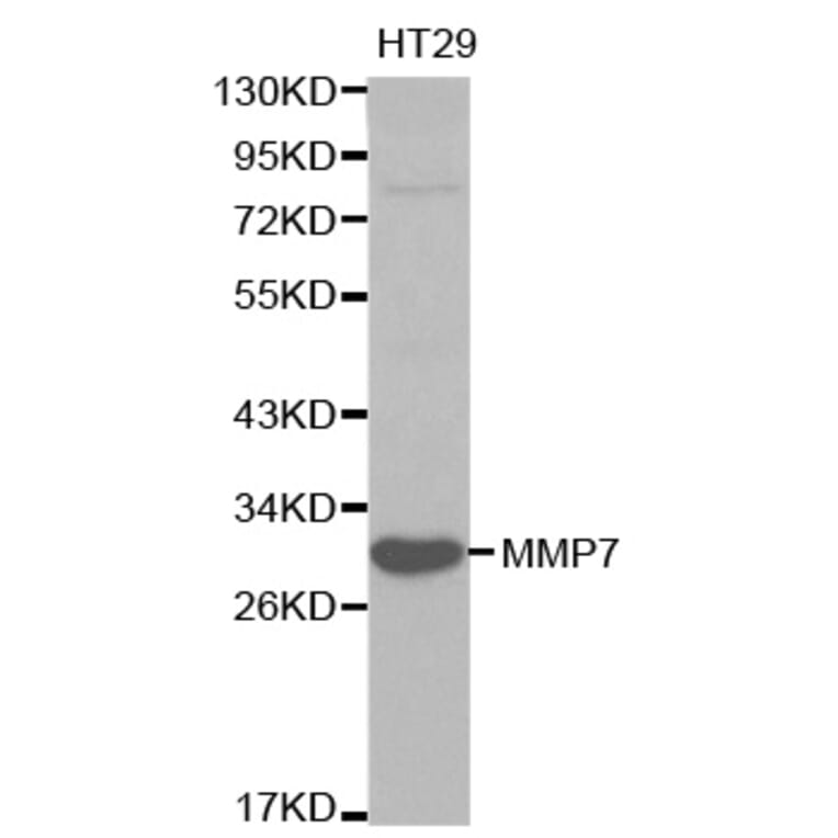 Western blot - MMP7 Antibody from Signalway Antibody (32086) - Antibodies.com