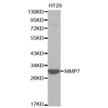 Western blot - MMP7 Antibody from Signalway Antibody (32086) - Antibodies.com