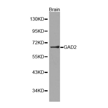 Western blot - GAD2 Antibody from Signalway Antibody (32100) - Antibodies.com