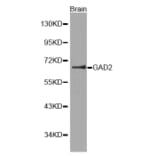 Western blot - GAD2 Antibody from Signalway Antibody (32100) - Antibodies.com