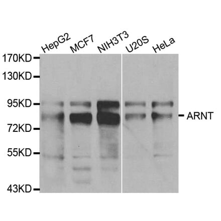 Western blot - ARNT Antibody from Signalway Antibody (32101) - Antibodies.com