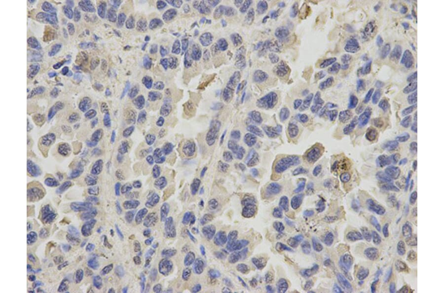 Immunohistochemistry - PPIA Antibody from Signalway Antibody (32114) - Antibodies.com
