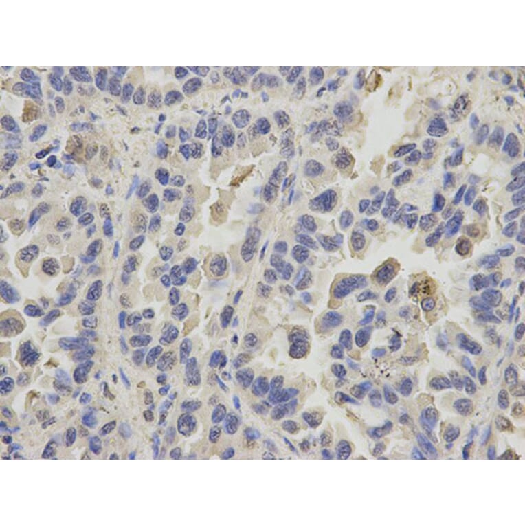 Immunohistochemistry - PPIA Antibody from Signalway Antibody (32114) - Antibodies.com