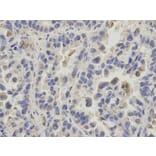 Immunohistochemistry - PPIA Antibody from Signalway Antibody (32114) - Antibodies.com