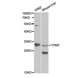 Western blot - TPMT Antibody from Signalway Antibody (32120) - Antibodies.com