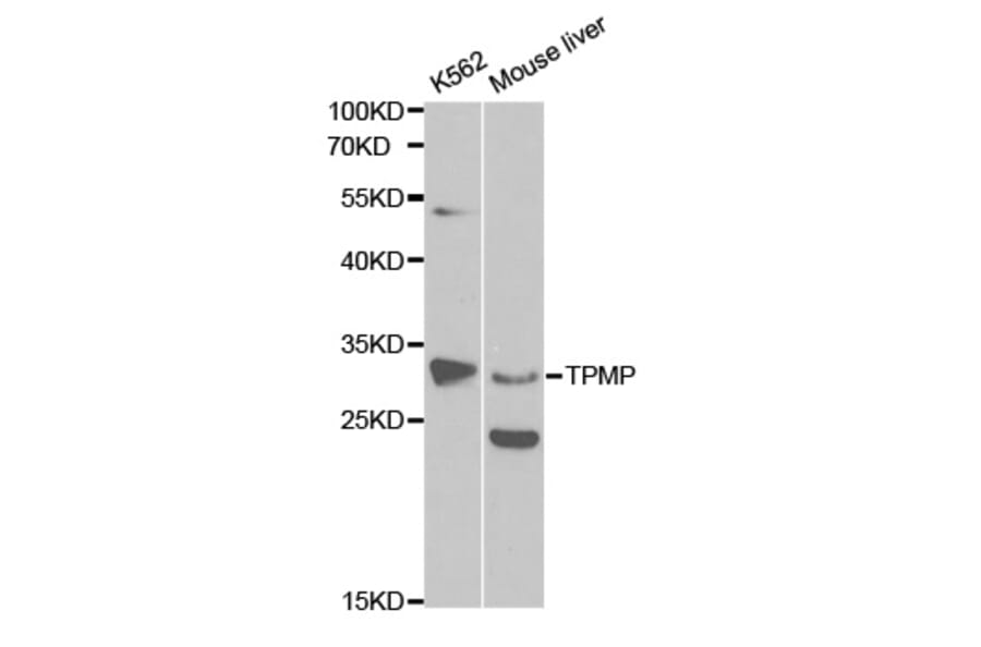 Western blot - TPMT Antibody from Signalway Antibody (32120) - Antibodies.com