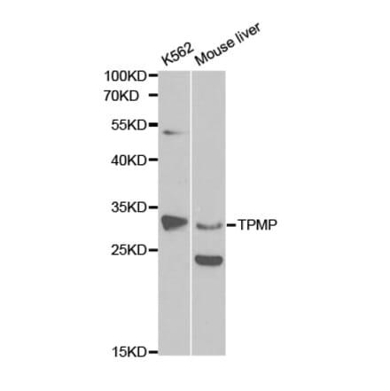 Western blot - TPMT Antibody from Signalway Antibody (32120) - Antibodies.com