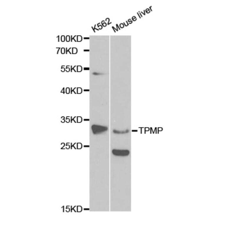 Western blot - TPMT Antibody from Signalway Antibody (32120) - Antibodies.com