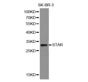 Western blot - STAR Antibody from Signalway Antibody (32129) - Antibodies.com