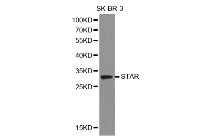 Western blot - STAR Antibody from Signalway Antibody (32129) - Antibodies.com